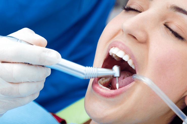 Root Canal Treatment (RCT)